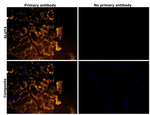GLUT4 Antibody in Immunohistochemistry (Paraffin) (IHC (P))
