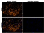 GLUT4 Recombinant Rabbit Monoclonal Antibody (PSH10-06)