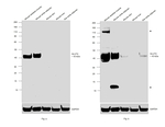 GLUT4 Antibody in Western Blot (WB)