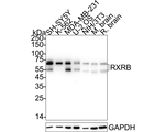 RXRB Antibody in Western Blot (WB)