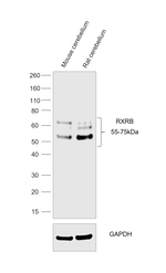 RXRB Antibody in Western Blot (WB)