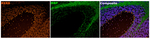 RXRB Antibody in Multiplex Immunohistochemistry (mIHC)