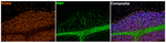 RXRB Antibody in Multiplex Immunohistochemistry (mIHC)