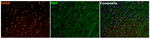 RXRB Antibody in Multiplex Immunohistochemistry (mIHC)