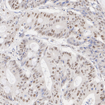 JMJD6 Antibody in Immunohistochemistry (Paraffin) (IHC (P))