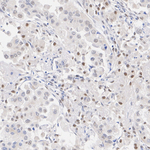 JMJD6 Antibody in Immunohistochemistry (Paraffin) (IHC (P))
