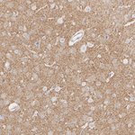 Synaptopodin Antibody in Immunohistochemistry (Paraffin) (IHC (P))