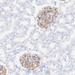Synaptopodin Antibody in Immunohistochemistry (Paraffin) (IHC (P))