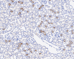 NKCC2 Antibody in Immunohistochemistry (Paraffin) (IHC (P))