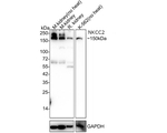 NKCC2 Antibody in Western Blot (WB)