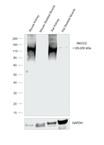 NKCC2 Antibody in Western Blot (WB)