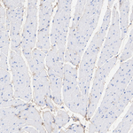 Decorin Antibody in Immunohistochemistry (Paraffin) (IHC (P))