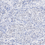 p300 Antibody in Immunohistochemistry (Paraffin) (IHC (P))