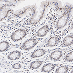 p300 Antibody in Immunohistochemistry (Paraffin) (IHC (P))