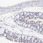 p300 Antibody in Immunohistochemistry (Paraffin) (IHC (P))