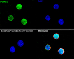 PSMB5 Antibody in Immunocytochemistry (ICC/IF)