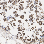 PSMB5 Antibody in Immunohistochemistry (Paraffin) (IHC (P))