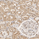 PSMB5 Antibody in Immunohistochemistry (Paraffin) (IHC (P))