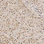 PSMB5 Antibody in Immunohistochemistry (Paraffin) (IHC (P))