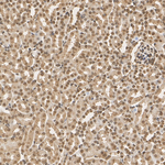 PSMB5 Antibody in Immunohistochemistry (Paraffin) (IHC (P))