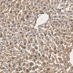 PSMB5 Antibody in Immunohistochemistry (Paraffin) (IHC (P))