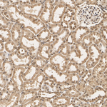 PSMB5 Antibody in Immunohistochemistry (Paraffin) (IHC (P))