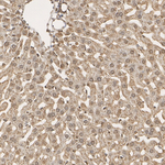 PSMB5 Antibody in Immunohistochemistry (Paraffin) (IHC (P))