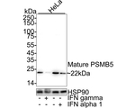 PSMB5 Antibody in Western Blot (WB)