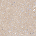 AMPK alpha-1,2 Antibody in Immunohistochemistry (Paraffin) (IHC (P))