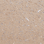 AMPK alpha-1,2 Antibody in Immunohistochemistry (Paraffin) (IHC (P))