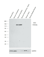 DCC Antibody in Western Blot (WB)