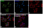 TREM2 Recombinant Rabbit Monoclonal Antibody (PSH18-55)