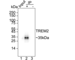 TREM2 Antibody in Immunoprecipitation (IP)
