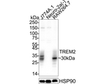 TREM2 Antibody in Western Blot (WB)