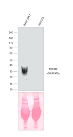 TREM2 Antibody in Western Blot (WB)
