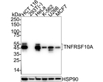 DR4 Antibody in Western Blot (WB)