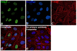FOXL2 Antibody in Immunocytochemistry (ICC/IF)