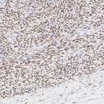 FOXL2 Antibody in Immunohistochemistry (Paraffin) (IHC (P))