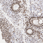 FOXL2 Antibody in Immunohistochemistry (Paraffin) (IHC (P))