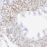 FOXL2 Antibody in Immunohistochemistry (Paraffin) (IHC (P))