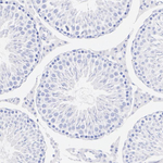FOXL2 Antibody in Immunohistochemistry (Paraffin) (IHC (P))