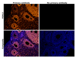 FOXL2 Antibody in Immunohistochemistry (Paraffin) (IHC (P))
