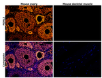 FOXL2 Antibody in Immunohistochemistry (Paraffin) (IHC (P))