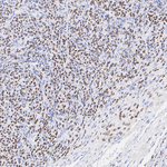 FOXL2 Antibody in Immunohistochemistry (Paraffin) (IHC (P))