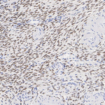 FOXL2 Antibody in Immunohistochemistry (Paraffin) (IHC (P))
