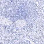 FOXL2 Antibody in Immunohistochemistry (Paraffin) (IHC (P))