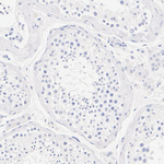 FOXL2 Antibody in Immunohistochemistry (Paraffin) (IHC (P))