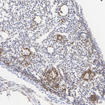 FOXL2 Antibody in Immunohistochemistry (Paraffin) (IHC (P))
