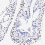 FOXL2 Antibody in Immunohistochemistry (Paraffin) (IHC (P))