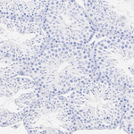 FOXL2 Antibody in Immunohistochemistry (Paraffin) (IHC (P))